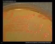 pseudomonas on deoxycholate citrate agar